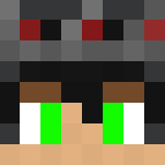 My skin