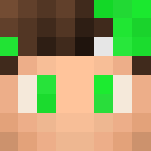 MY SKIN!