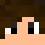 MC skin