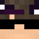 Edited Skin