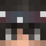 This is My real skin