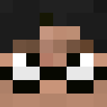 My Skin (Fixed)