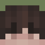 My skin (read desc)